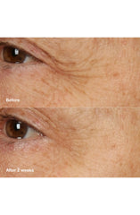 Clinique Smart Clinical Repair Overnight Recovery Cream + Mask