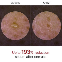 Dr. Melaxin Peel Shot Exfoliating White Rice Ampoule