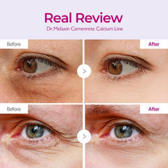 Dr. Melaxin Cemenrete Calcium Volume Eye Patch