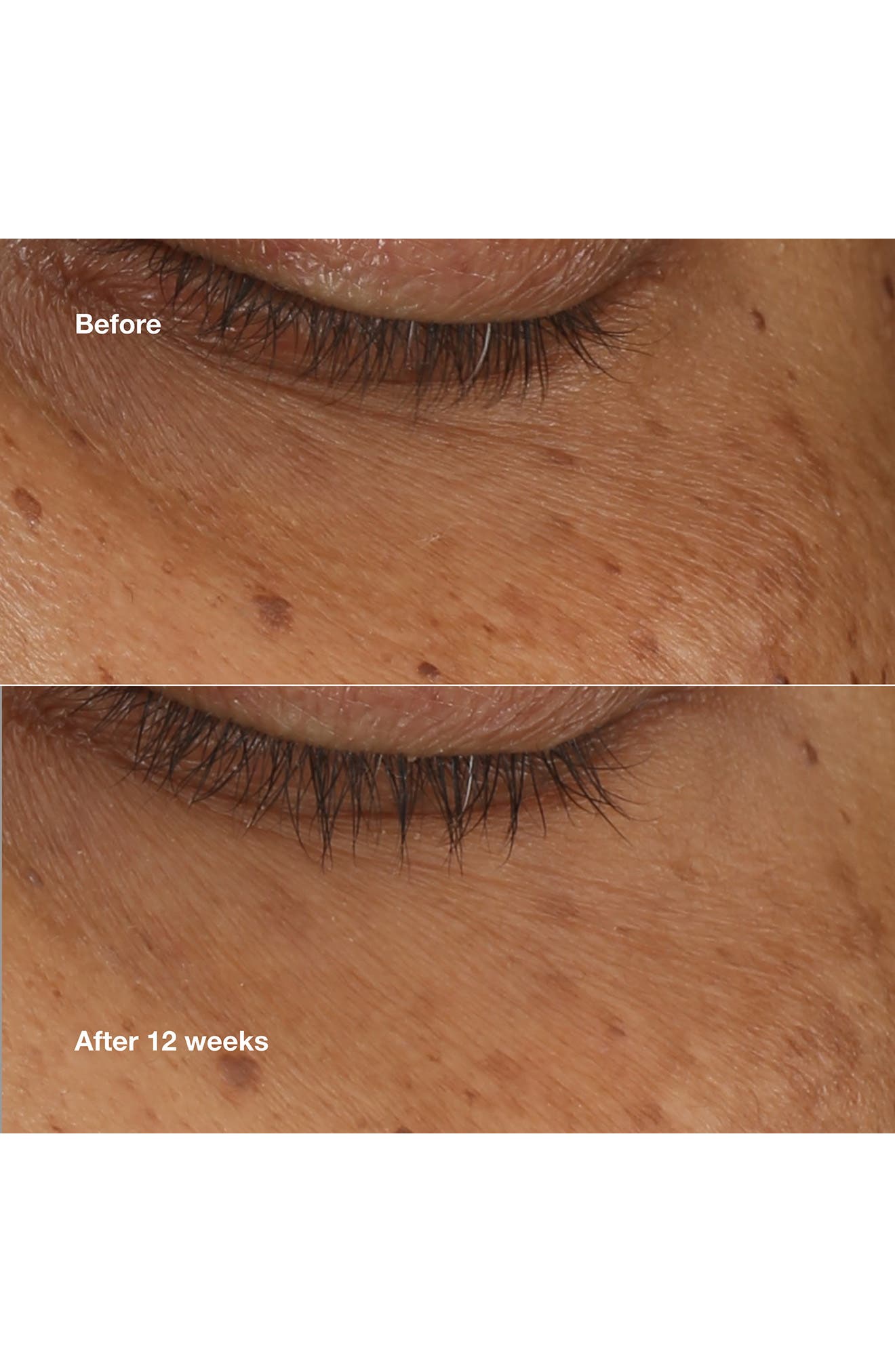 Clinique All About Eyes Brightening Serum Concentrate