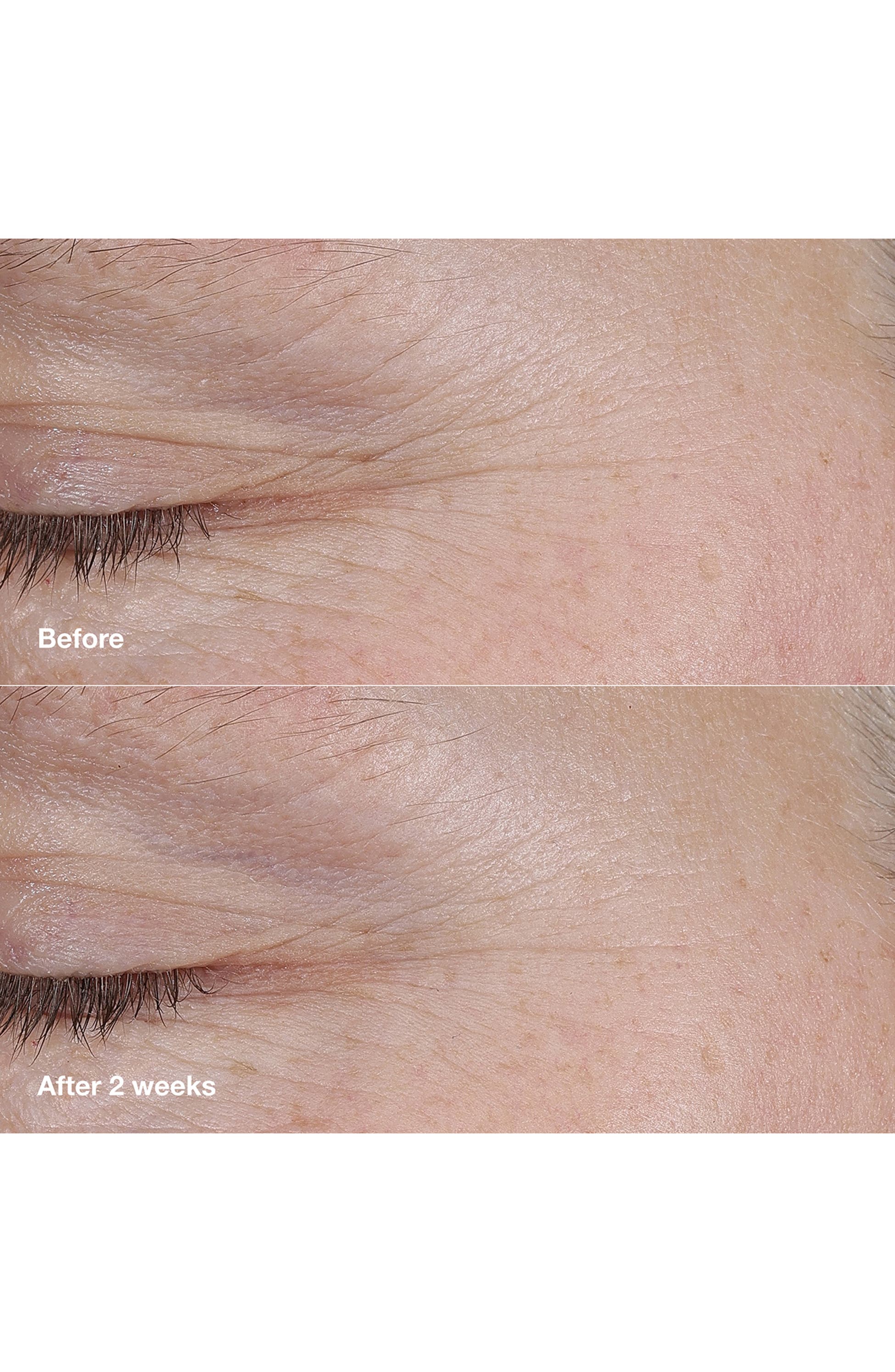 Clinique Smart Clinical Repair AM/PM Retinoid Balm