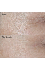 Clinique Smart Clinical Repair Broad Spectrum SPF 30 Wrinkle Correcting Cream