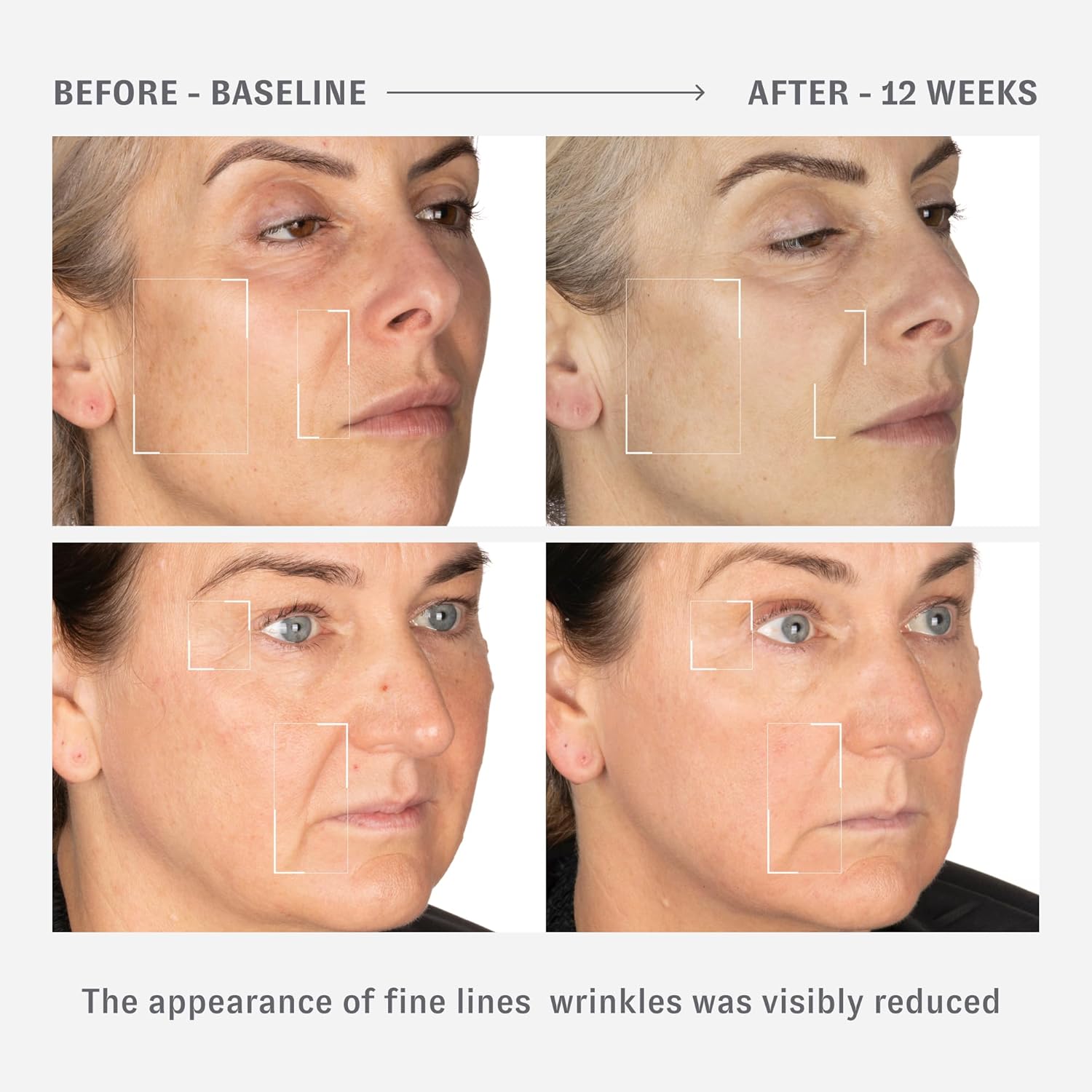 OHUI Reverse Activator Retinol Wrinkle Cream