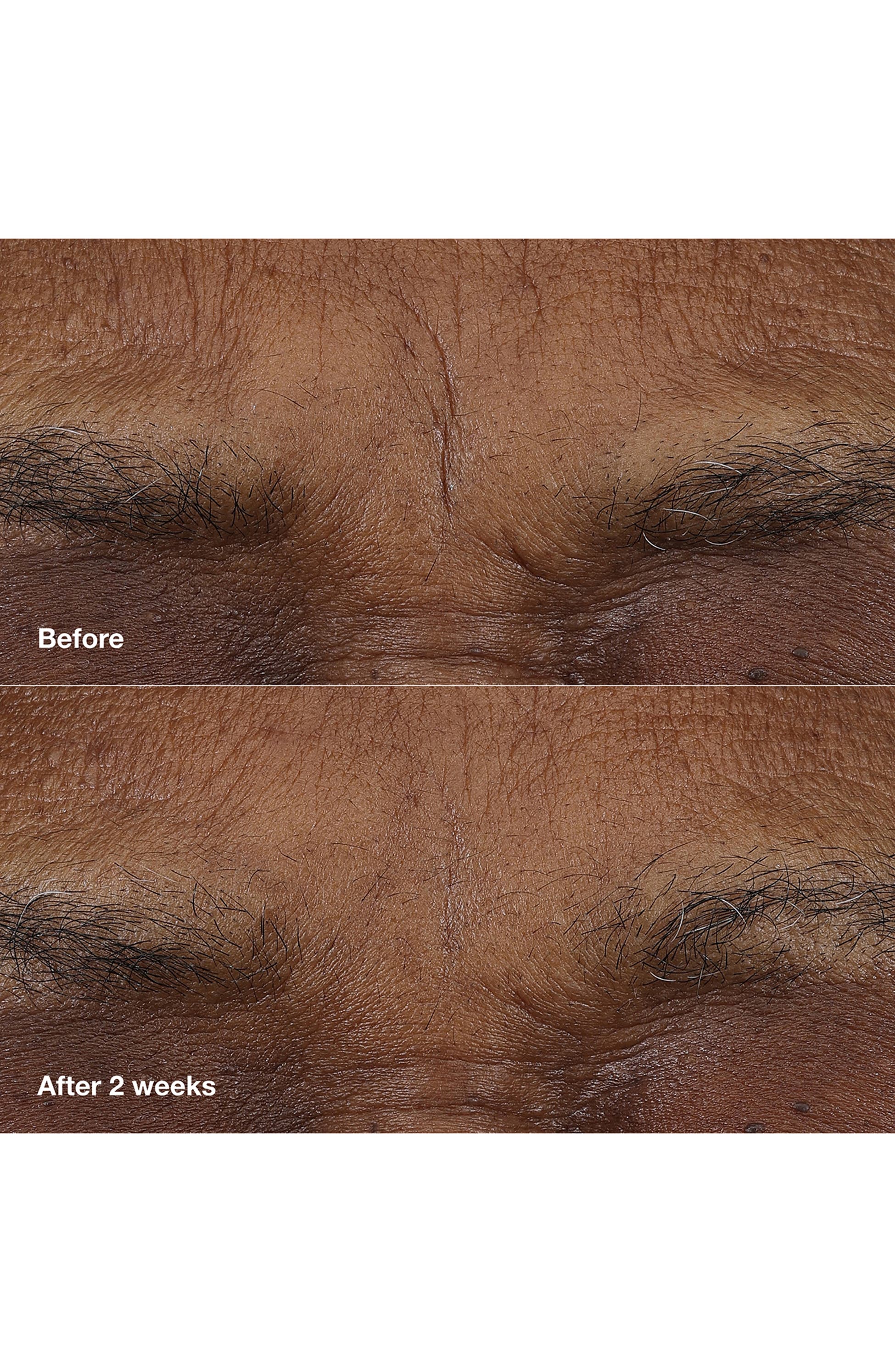 Clinique Smart Clinical Repair AM/PM Retinoid Balm